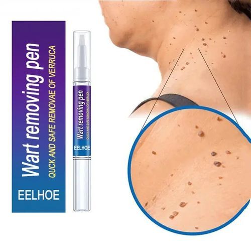 Wart Remover Cream –  Quick & Safe Removal Pen