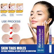 Wart Remover Cream –  Quick & Safe Removal Pen