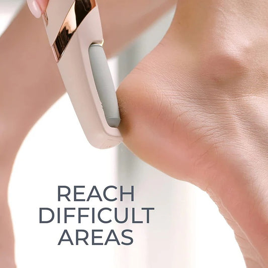 Callus Remover